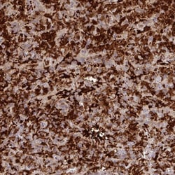 Biliverdin Reductase A/BLVRA Antibody, Novus Biologicals:Antibodies:Primary