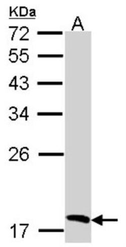 Biliverdin Reductase B/BLVRB Antibody, Novus Biologicals 0.1mL; Unlabeled:Antibodies,