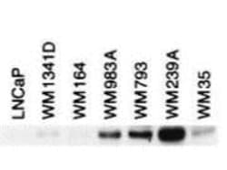 BIN1 Antibody (12A), Novus Biologicals 0.1mg; Unlabeled:Antibodies, Monoclonal