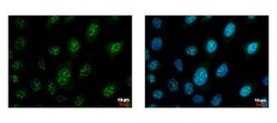 BIN1 Antibody, Novus Biologicals 0.1 mL | Buy Online | Novus Biologicals | Fisher Scientific