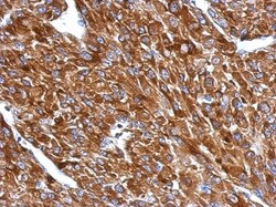 BIN1 Antibody, Novus Biologicals 0.1 mL | Buy Online | Novus Biologicals | Fisher Scientific