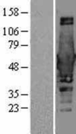 Novus Biologicals&trade;&nbsp;BIN1 Overexpression Lysate
