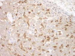 BIN1 Antibody, Novus Biologicals 100 &mu;L | Buy Online | Novus Biologicals | Fisher Scientific