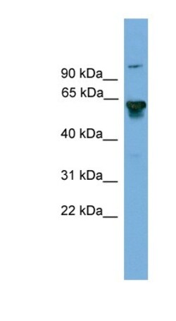 BIN2 Antibody, Novus Biologicals:Antibodies:Primary Antibodies