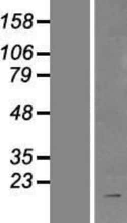 Novus Biologicals&trade;&nbsp;BIRC8 Overexpression Lysate