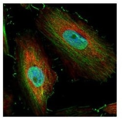BIVM Antibody, Novus Biologicals 0.1mg; Unlabeled:Antibodies, Polyclonal