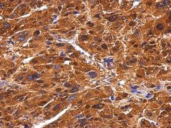 BIVM Antibody, Novus Biologicals 0.1mg; Unlabeled:Antibodies, Polyclonal