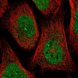 BLACE Antibody, Novus Biologicals:Antibodies:Primary Antibodies