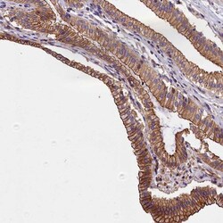 BLACE Antibody, Novus Biologicals:Antibodies:Primary Antibodies