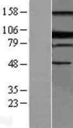 Novus Biologicals&trade;&nbsp;BLIMP1/PRDM1 Overexpression Lysate