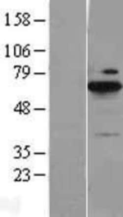 Novus Biologicals&trade;&nbsp;BLNK Overexpression Lysate