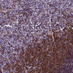 BLNK Antibody, Novus Biologicals:Antibodies:Primary Antibodies