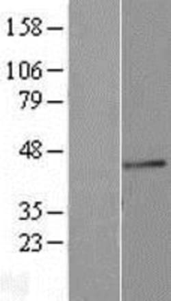Novus Biologicals&trade;&nbsp;Fucosyltransferase 3/FUT3 Overexpression Lysate