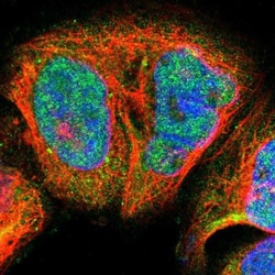 Blooms Syndrome Protein Blm Antibody, Novus Biologicals 0.1mL; Unlabeled:Antibodies,