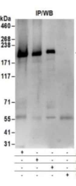 Blooms Syndrome Protein Blm Antibody, Novus Biologicals 0.1mg; Unlabeled:Antibodies,