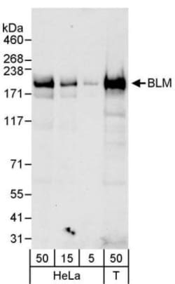 Blooms Syndrome Protein Blm Antibody, Novus Biologicals 0.1mg; Unlabeled:Antibodies,