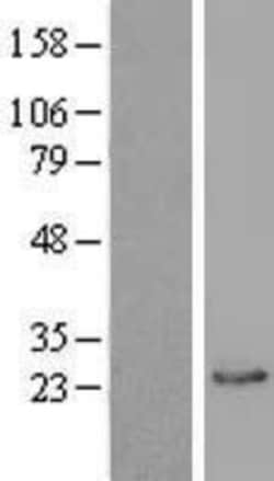 Novus Biologicals™ Biliverdin Reductase B/BLVRB Overexpression Lysate