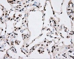 BMAL1 Antibody (OTI1C11), Novus Biologicals 0.1mL; Unlabeled:Antibodies,