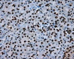 BMAL1 Antibody (OTI1C11), Novus Biologicals 0.1mL; Unlabeled:Antibodies,