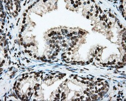 BMAL1 Antibody (OTI1C11), Novus Biologicals 0.1mL; Unlabeled:Antibodies,