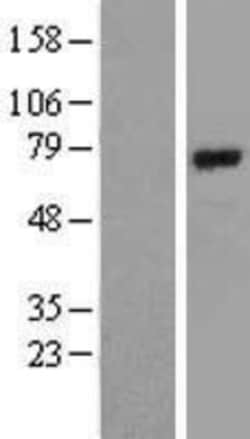 Novus Biologicals™ BMAL1 Overexpression Lysate