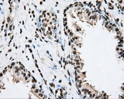 BMAL1 Antibody (OTI1C11), Novus Biologicals 0.1mL; Unlabeled:Antibodies,