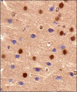 BMAL1 Antibody, Novus Biologicals:Antibodies:Primary Antibodies