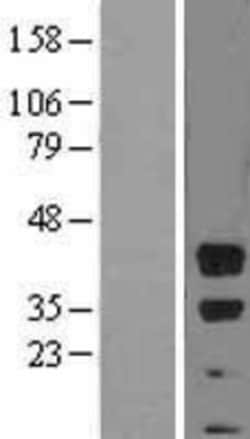 Novus Biologicals&trade;&nbsp;BMI-1 Overexpression Lysate