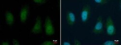 BMI-1 Antibody, Novus Biologicals 0.1mg; Unlabeled:Antibodies, Polyclonal