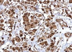 BMI-1 Antibody, Novus Biologicals 0.1mg; Unlabeled:Antibodies, Polyclonal