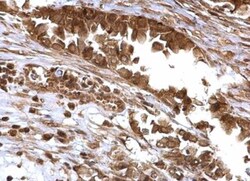 BMI-1 Antibody, Novus Biologicals 0.1mg; Unlabeled:Antibodies, Polyclonal