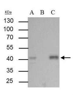 BMI-1 Antibody, Novus Biologicals 0.1mg; Unlabeled:Antibodies, Polyclonal