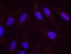 BMI-1 Antibody, Novus Biologicals 0.1mg; Unlabeled:Antibodies, Polyclonal