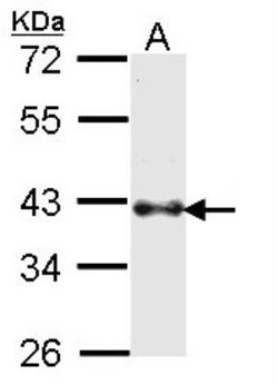 BMI-1 Antibody, Novus Biologicals 0.1mg; Unlabeled:Antibodies, Polyclonal