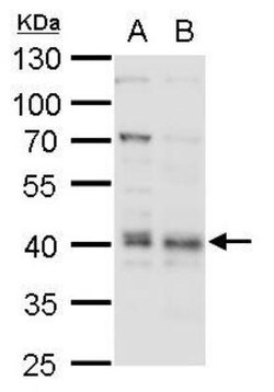 BMI-1 Antibody, Novus Biologicals 0.1mg; Unlabeled:Antibodies, Polyclonal
