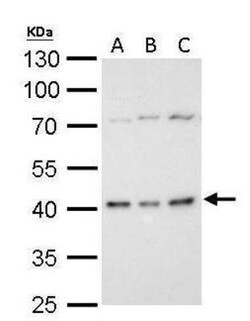 BMI-1 Antibody, Novus Biologicals 0.1mg; Unlabeled:Antibodies, Polyclonal