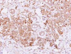 BMP-15/GDF-9B Antibody, Novus Biologicals 0.1mL; Unlabeled:Antibodies,