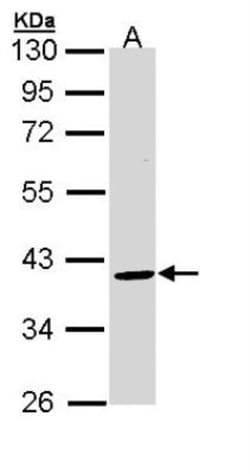 BMP-15/GDF-9B Antibody, Novus Biologicals 0.1mL; Unlabeled:Antibodies,