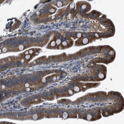 BMP-1/PCP Antibody, Novus Biologicals 0.1mL; Unlabeled:Antibodies, Polyclonal