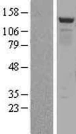 Novus Biologicals&trade;&nbsp;BMP2K Overexpression Lysate