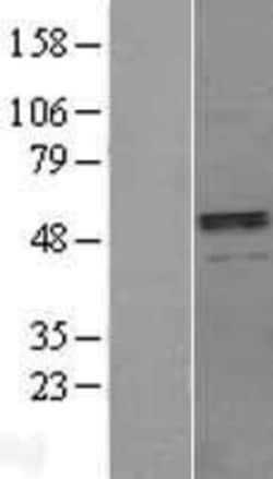 Novus Biologicals&trade;&nbsp;BMP-3 Overexpression Lysate