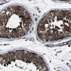 BMP-3b/GDF-10 Antibody, Novus Biologicals:Antibodies:Primary Antibodies