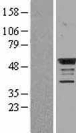 Novus Biologicals&trade;&nbsp;BMP-4 Overexpression Lysate