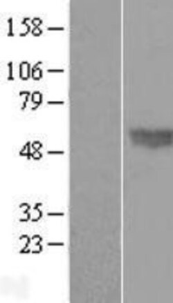 Novus Biologicals&trade;&nbsp;BMP-4 Overexpression Lysate