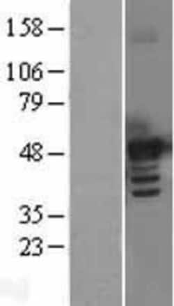 Novus Biologicals™ BMP-7 Overexpression Lysate