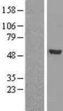 Novus Biologicals&trade;&nbsp;BMP-9 Overexpression Lysate