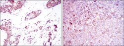 BMPR-II Antibody (1F12), Novus Biologicals 0.1mL; Unlabeled:Antibodies,