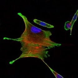 BMPR-II Antibody (3F6), Novus Biologicals:Antibodies:Primary Antibodies