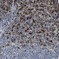 BMPR-II Antibody, Novus Biologicals 25 &mu;L; Unlabeled:Anticorps, Polyclonal