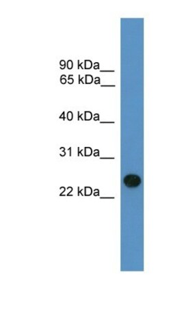 BNIP1 Antibody, Novus Biologicals:Antibodies:Primary Antibodies